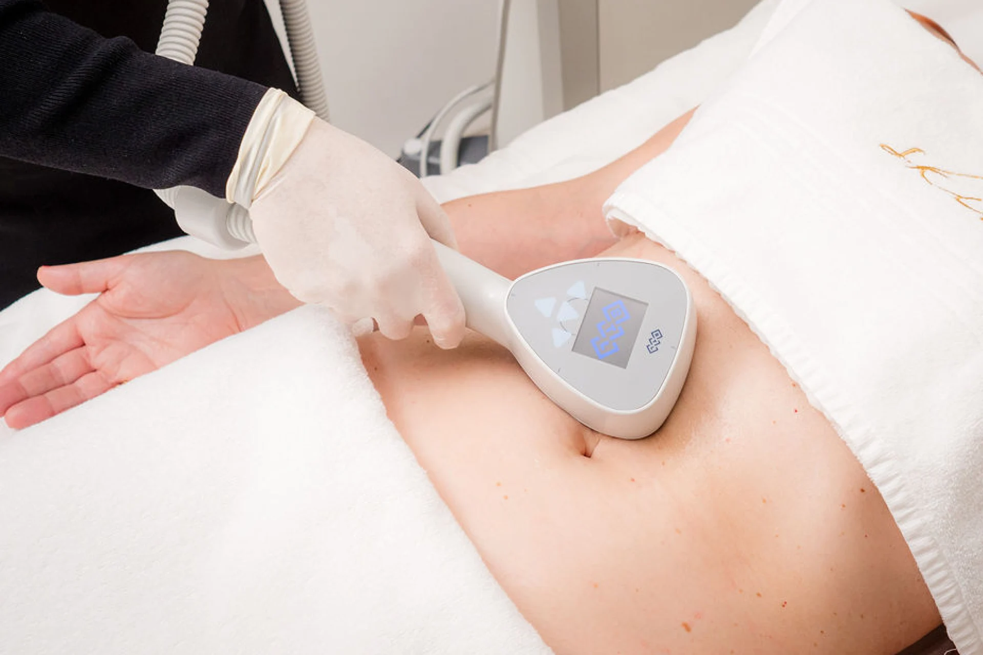 Exilis Ultra 360