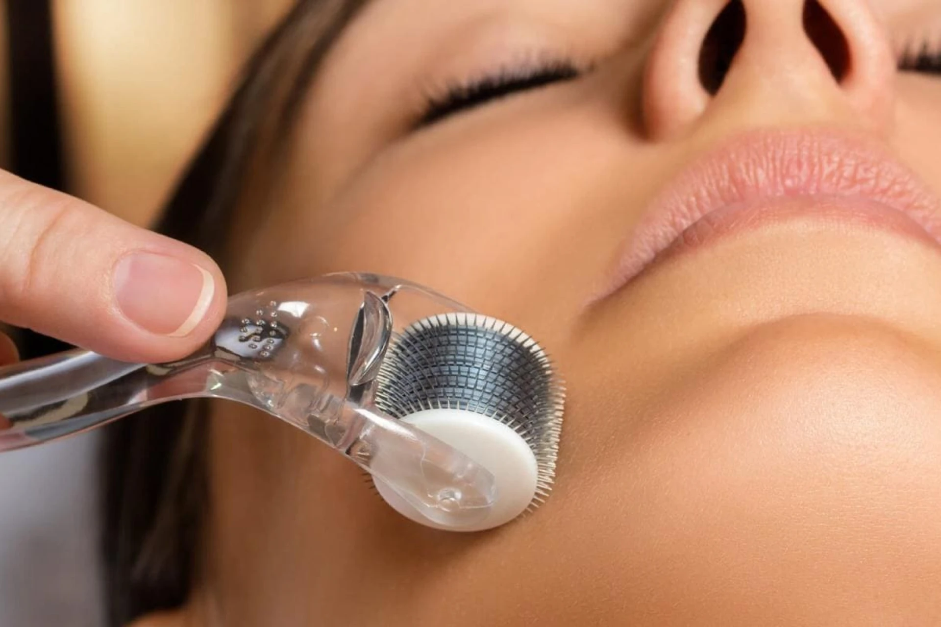 Microneedling (Dermapen)